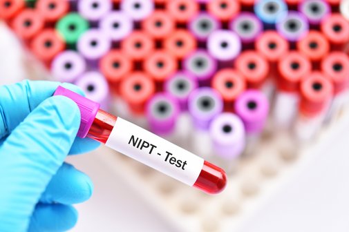 NIP-Test in der Schwangerschaft Eine Hand mit einem blauen Gummihandschuh hält ein Röhrchen mit einer Blutprobe, es ist mit "NIPT-Test" beschriftet. Im Hintergrund mehr Blutproben.